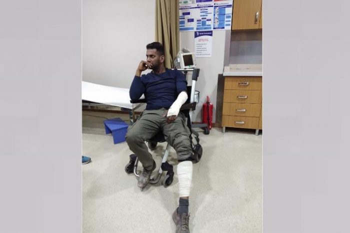 Vishal injured 750 e1553792724363