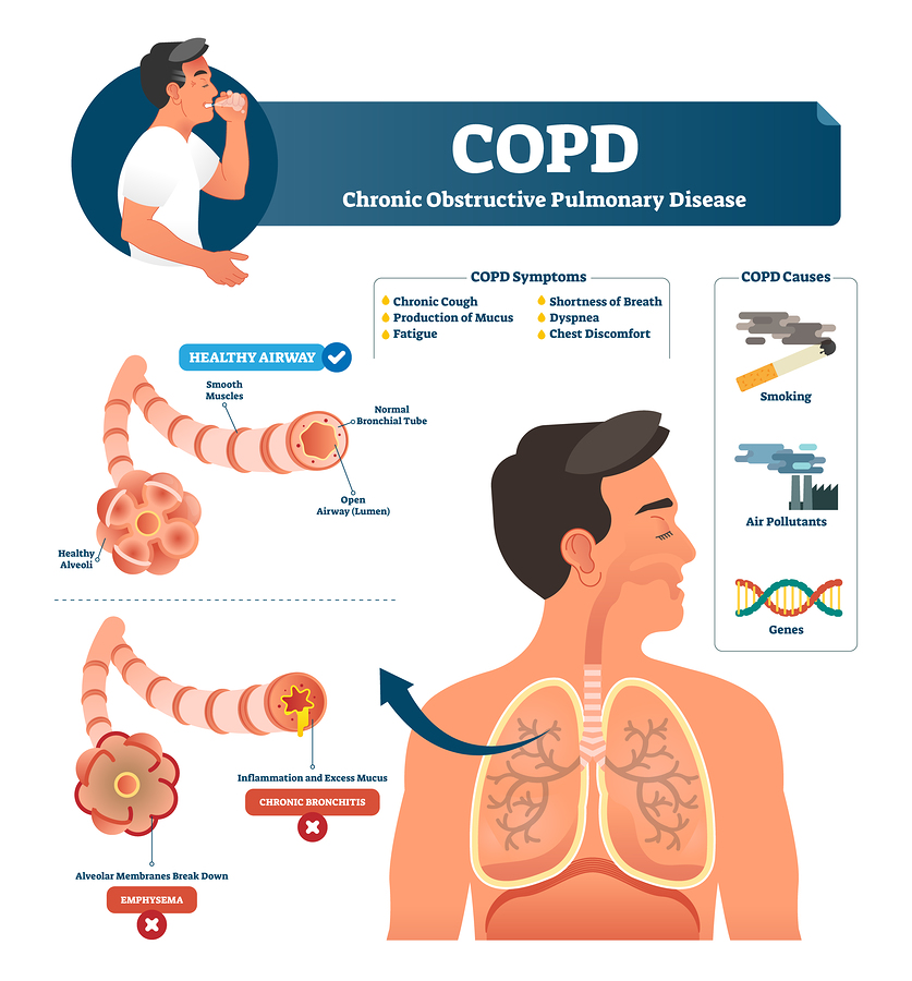 COPD Symptoms